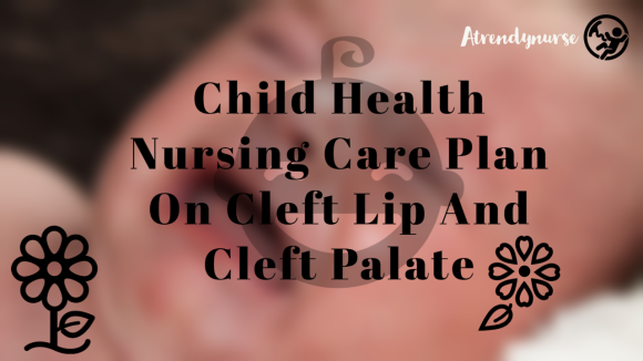 Child Health Nursing Care Plan On Cleft Lip And Cleft Palate