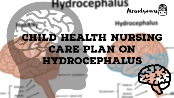 Child Health Nursing Care Plan On Hydrocephalus