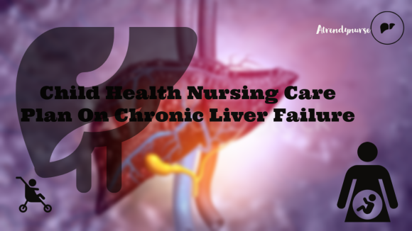 Child Health Nursing Care Plan On Chronic Liver Failure