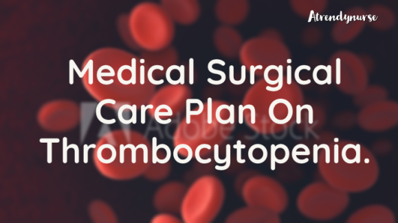 Medical Surgical Care Plan On Thrombocytopenia.