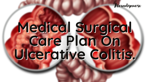 Medical Surgical Care Plan On Ulcerative Colitis.